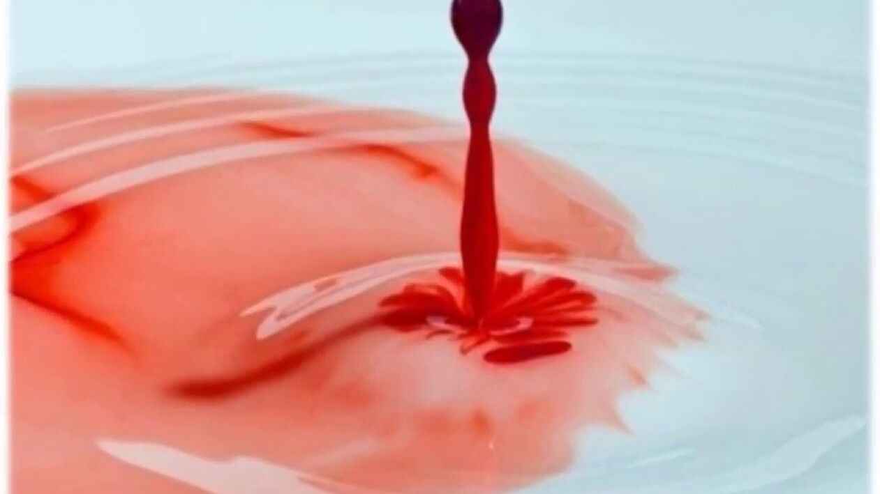 крвави исцједак из пениса