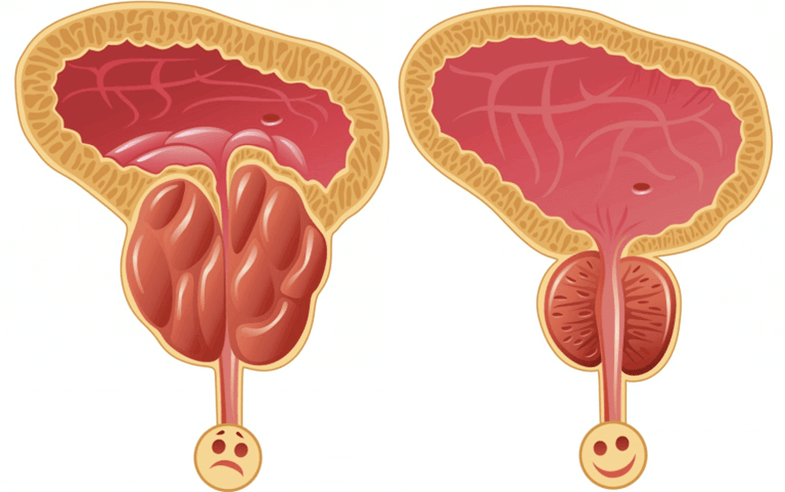 узроци проблема са потенцијом код мушкараца